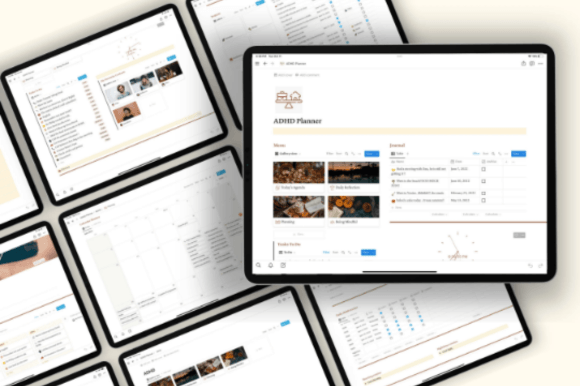 notion-template-adhd,-adhd-career-https://www.creativefabrica.com/wp-content/uploads/2024/03/07/Notion-Template-ADHD-Adhd-Career-Graphics-92721169-7-580x386.png